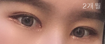 2개월.jpg