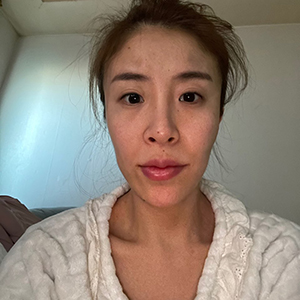 수술전 (1)300.jpg