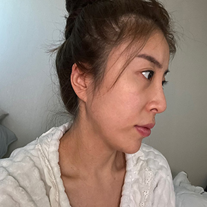 수술전 (2)300.jpg