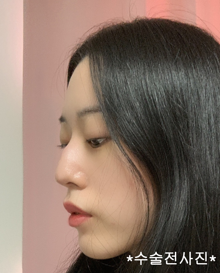 수술전 (2).jpg