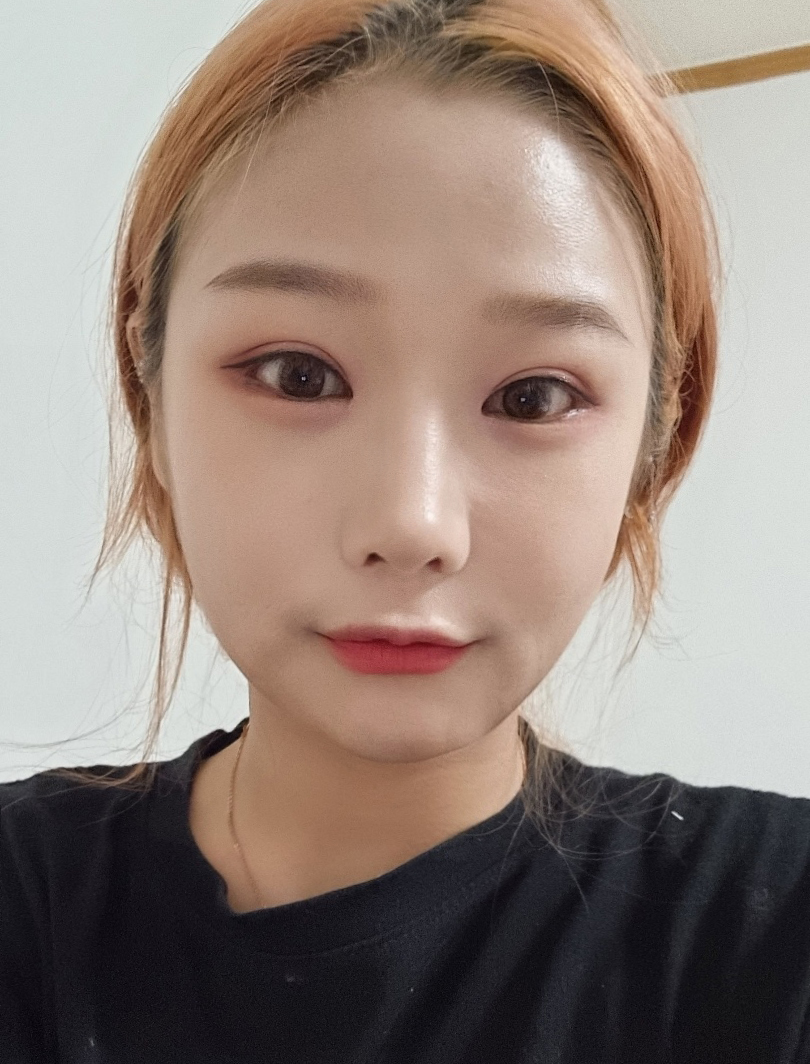 수술후 (2).jpg