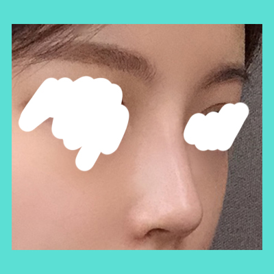수술후 (1).jpg