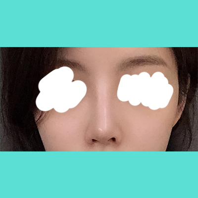 수술후 (2).jpg