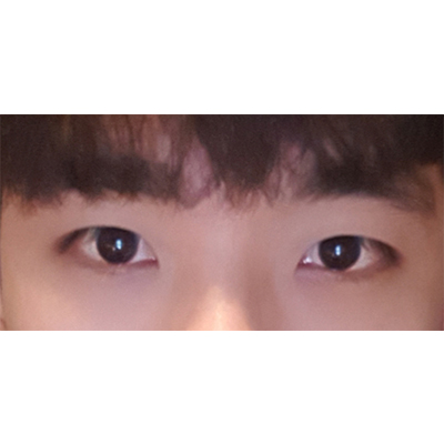 수술후 (1).jpg