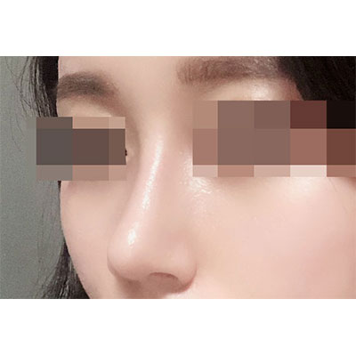 수술후 (2).jpg