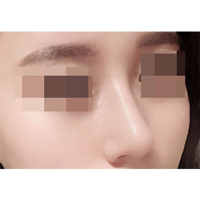 수술후 (1).jpg
