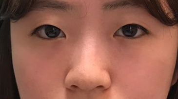 전 (1).jpg