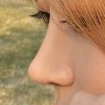 수술후2.jpg