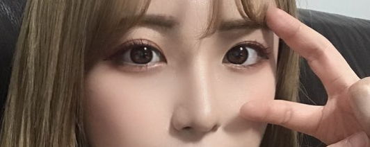 수술후1.jpg