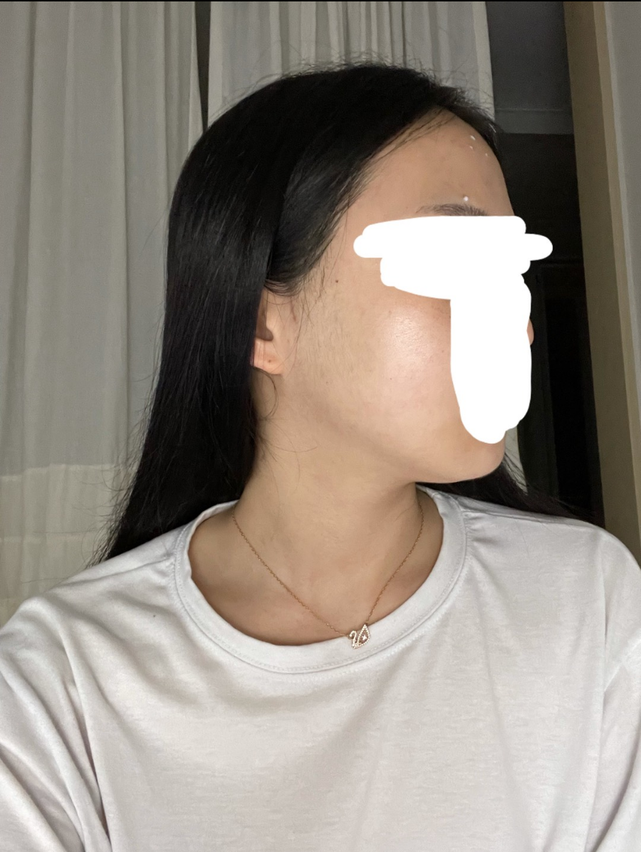수술후 (2).png