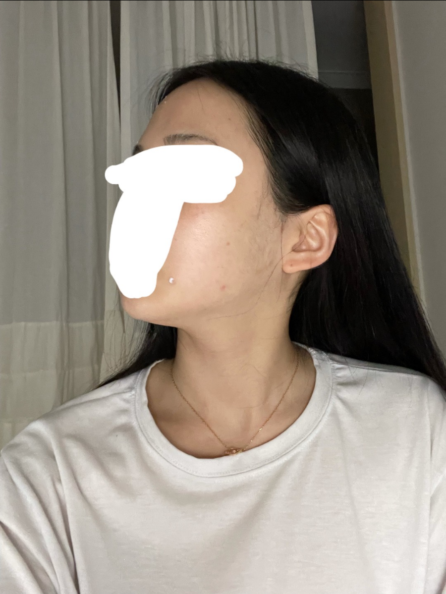 수술후 (3).png