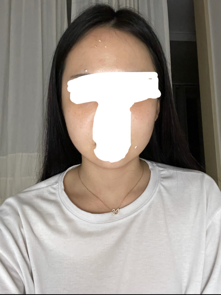 수술후 (1).png