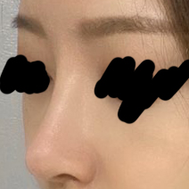수술후.jpg