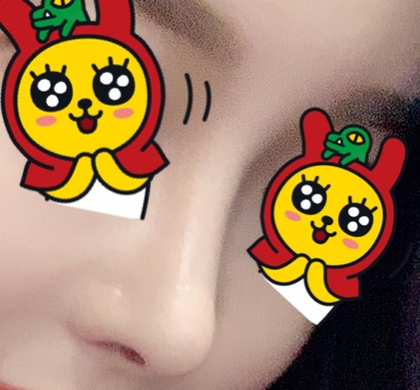 수술후 (1).jpg