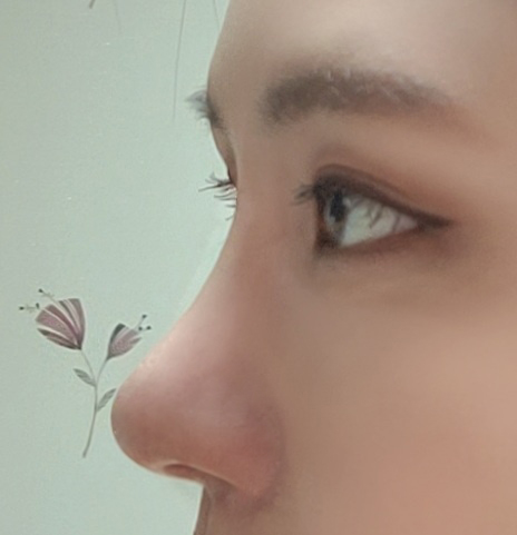 수술후.jpg