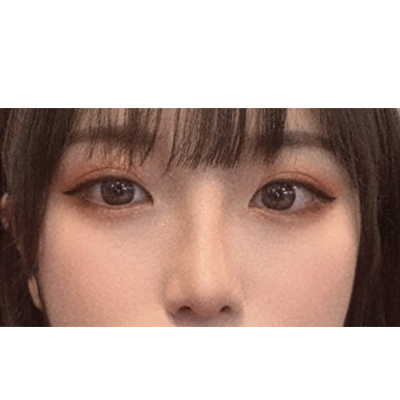 수술후 (2).png