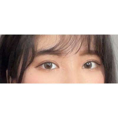 수술후 (1).jpg