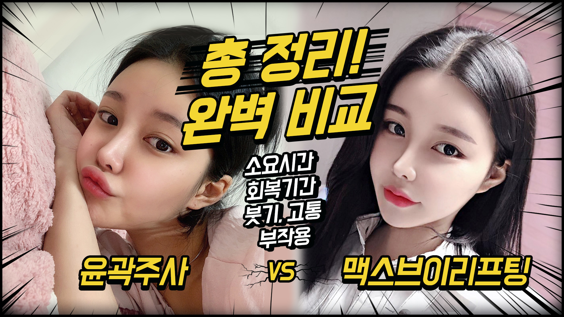 맥스브이리프팅(얼굴지방흡입) vs 윤곽주사 비교/나에게 맞는 시술방법은?