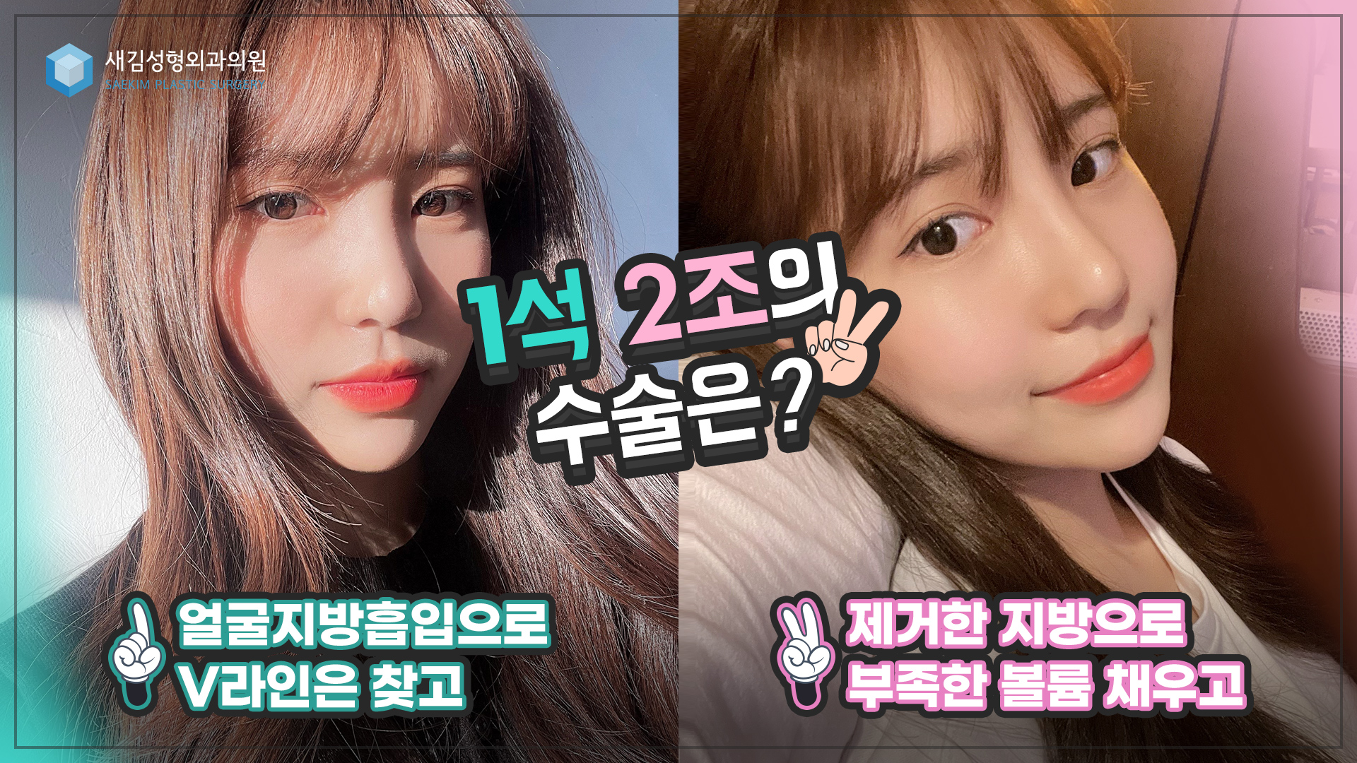 맥스브이리프팅(얼굴지방흡입)으로 동안이 될 수 있다고요?(⊙ˍ⊙)