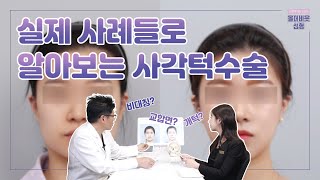 실제 사례들로 알아보는 사각턱 수술 EP2 / 실제수술후기로 전후 차이를 확인 (CT사진으로 보는 뼈의 변화)
