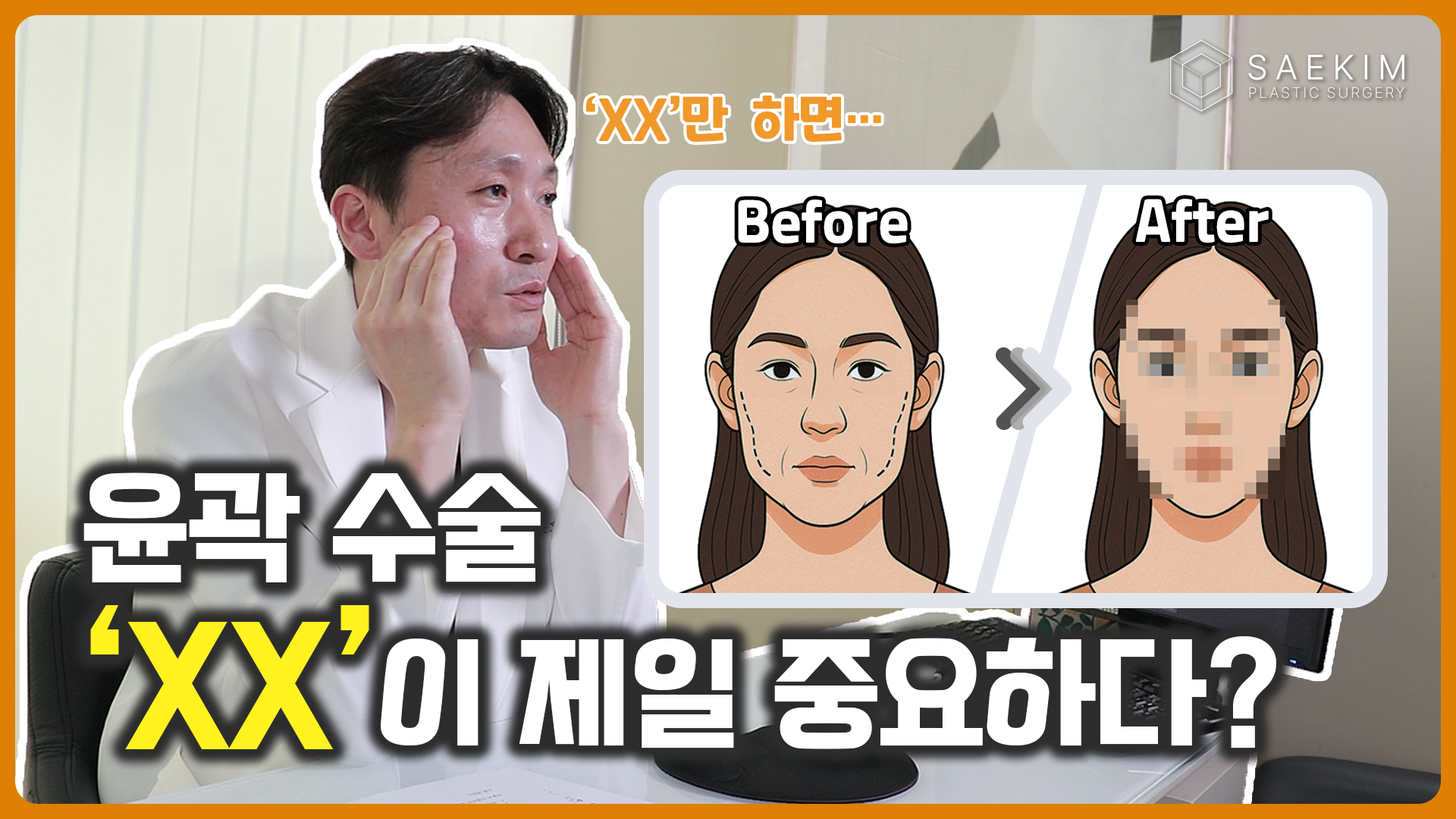 윤곽수술을 할 때 뭐가 가장 중요할까요? 가장 많이 하는 질문 모음!!!