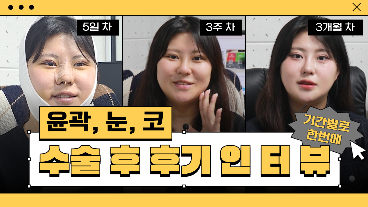 성형외과 직원이 직접 윤곽, 눈, 코 수술을 하고 말해주는 후기 수술 5일차, 3주 차, 3개월 차 공개!!!!!