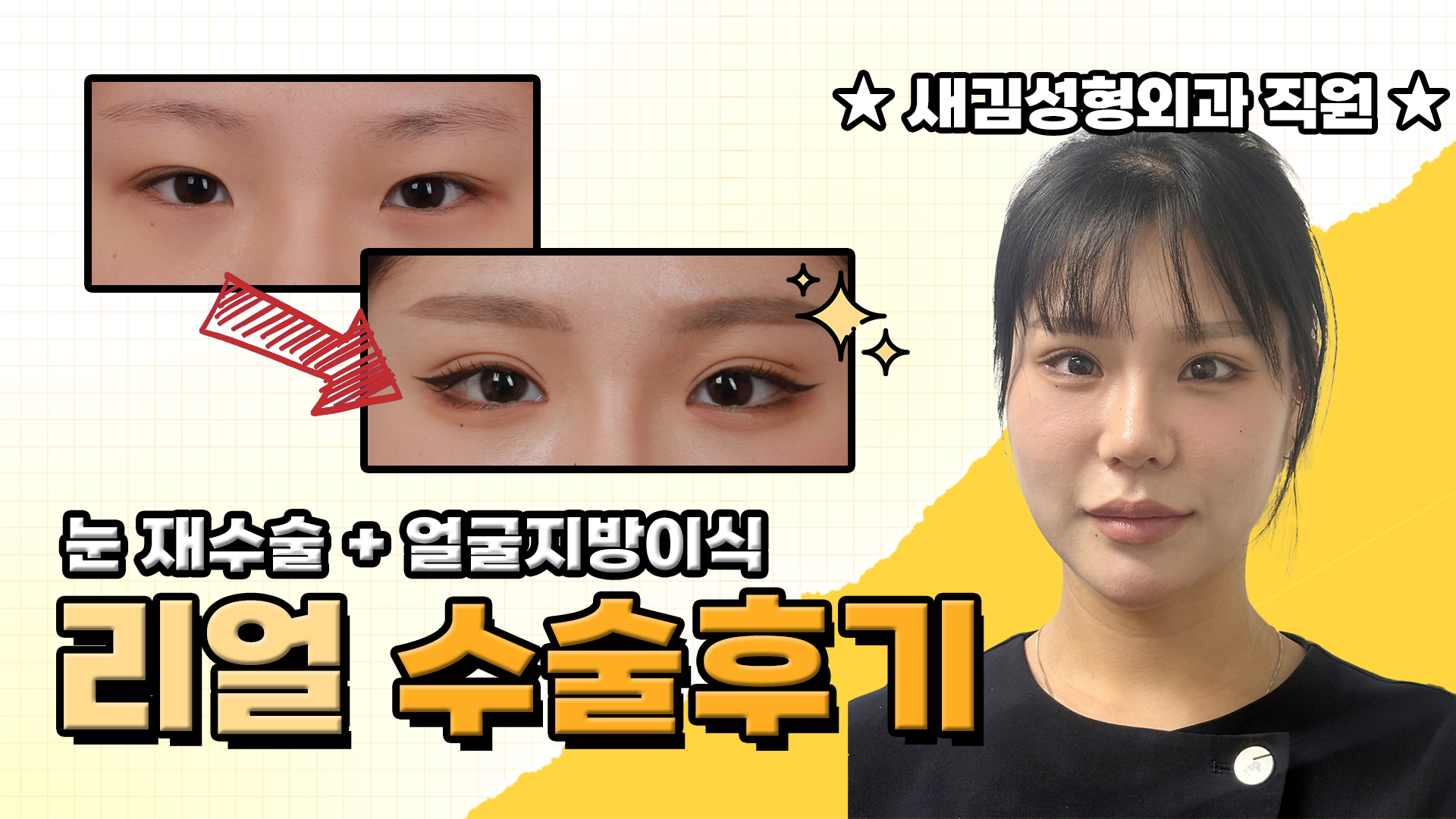 출근길에 수술한 사람의 결말… 보여드립니다