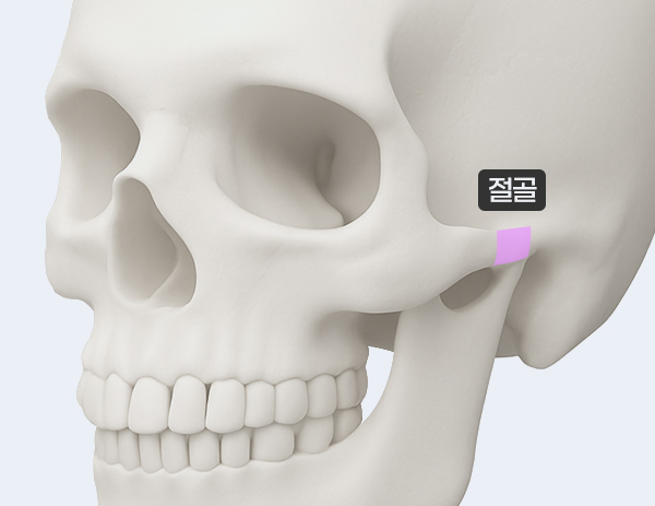 3세대 - 광대회전술