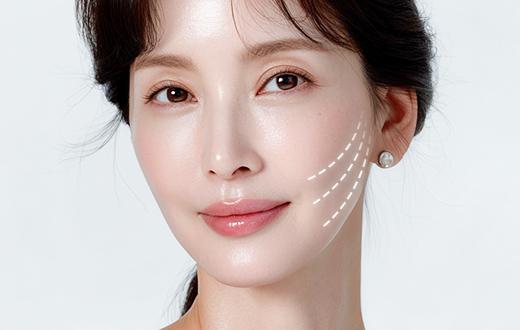 4050 리프팅 핵심 내용 03