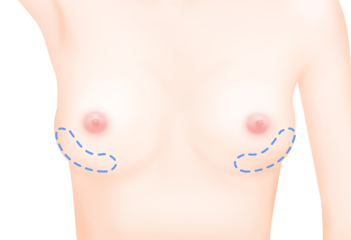 가슴 바깥 부분 확대