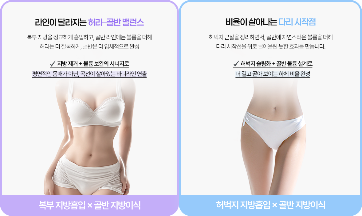 바디지방이식 타입