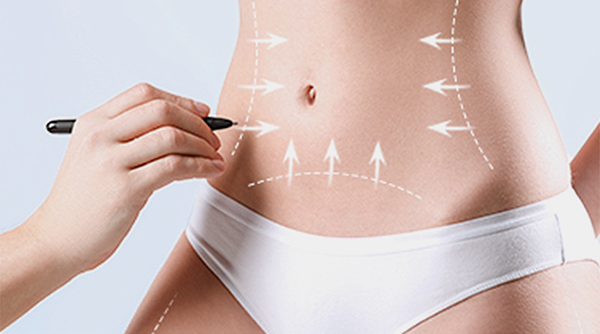 새김 바디지방흡입 수술방법 01