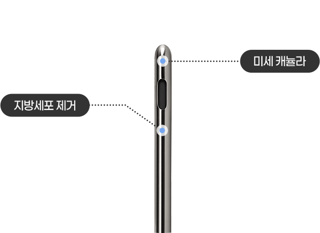 미세 캐뉼라 사용으로 섬세한 조형