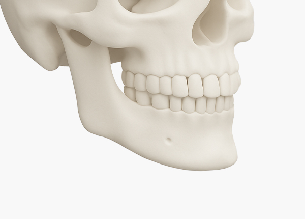 무턱보형물 수술방법 3. 절개 부위 봉합