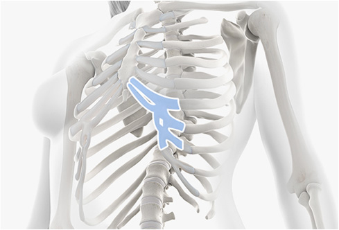 코성형 재료 - 늑연골