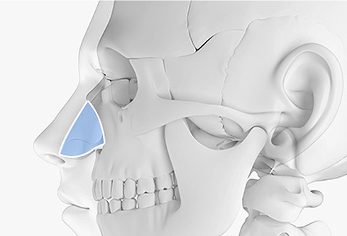 코성형 재료 - 비중격연골