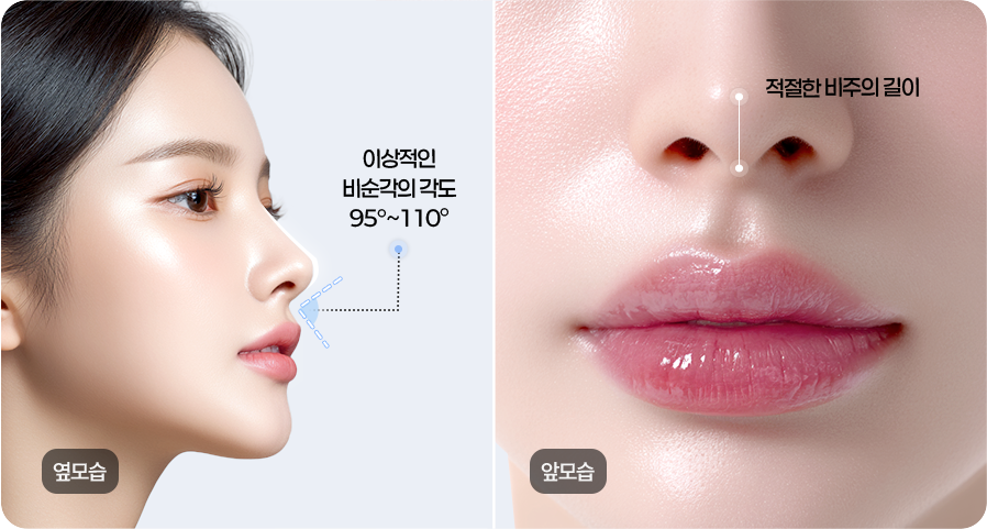 아름다운 옆모습, 비순각이 만듭니다.