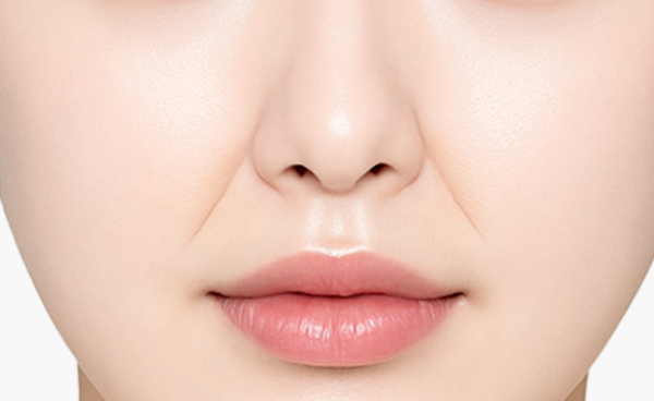 귀족보형물 수술 방법 1.개인별 팔자주름 부위의 상태를 파악