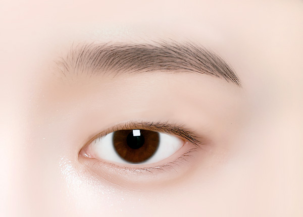 눈매교정 -절개 눈매교정 수술방법 01