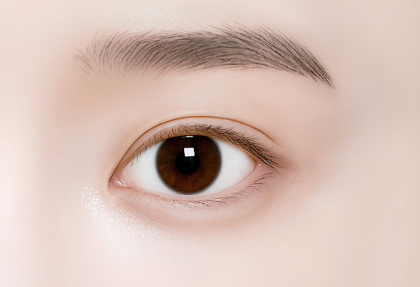 눈밑지방재배치 수술방법 04