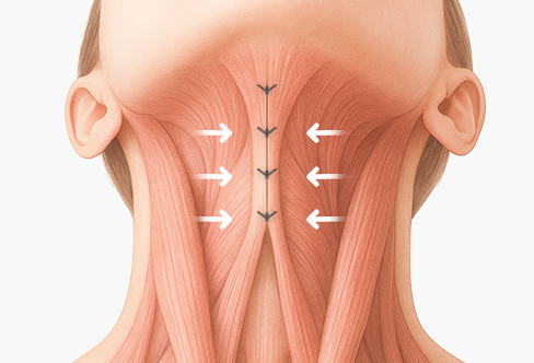 함께하면 더 좋은 수술 - 이중턱 근육묶기