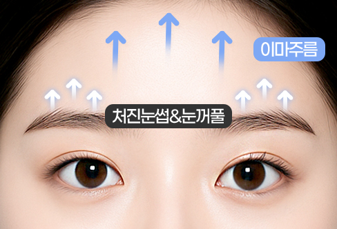 함께하면 더 좋은 수술 이마거상